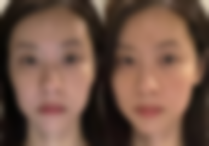 海南省人民医院激光美容整形科怎么样，口碑评价如何？