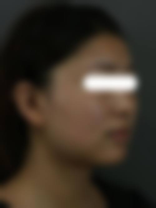 哈尔滨鹤菡整形医院怎么样——项目特色