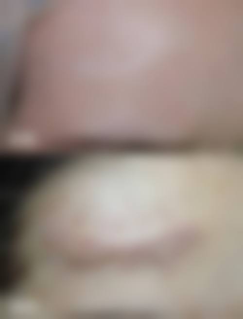 孙芳草医生口碑如何