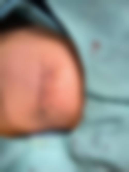 王文医生手术项目及点评