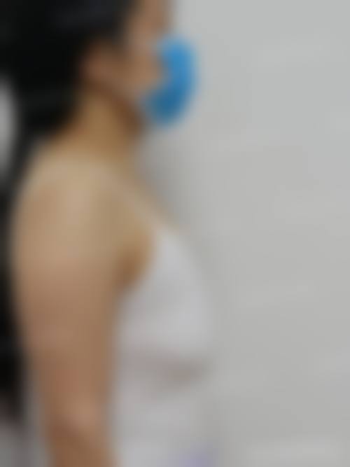 七、晋城芳华医疗美容医院怎么样：口碑好不好？附真实患者口碑评价