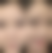 重庆蝶姿整形美容医院项目特色