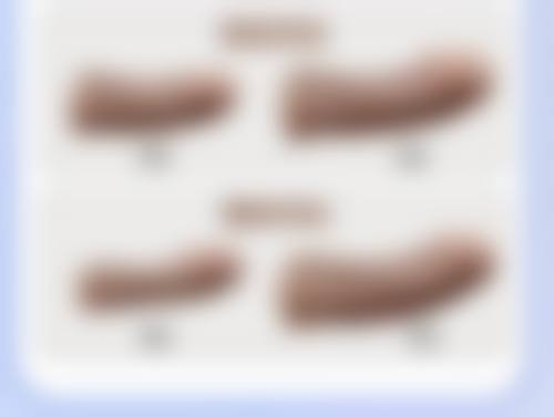 陈秀华医生简介项目优势