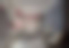 万磊医生做手术价格