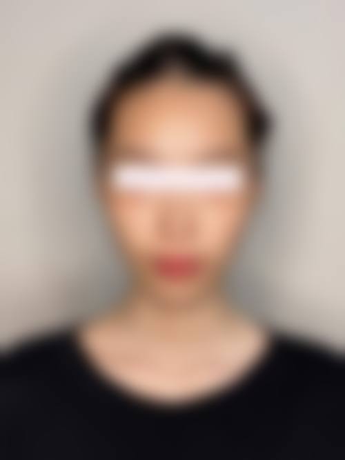 台州丽雅医疗美容门诊部顾客实例