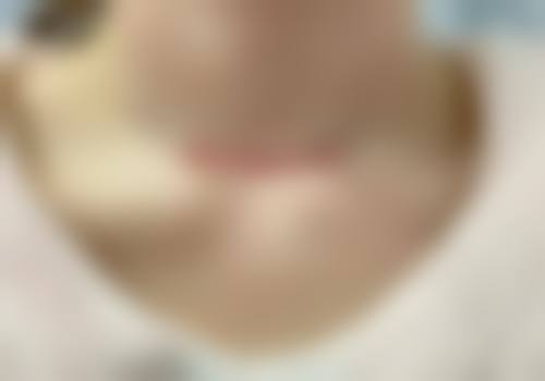 兰州三爱整形美容门诊部顾客实例