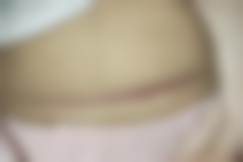 广州新发现整形医疗美容门诊部顾客实例