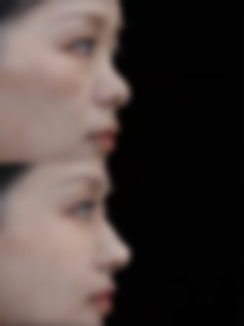 李嘉欣医生项目优势