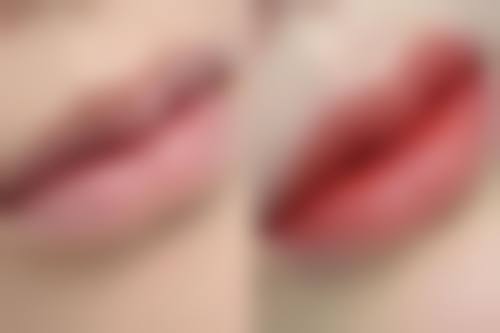 上海娜拉整形医疗美容门诊部地址在哪里