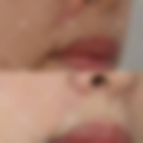 尹盛浩医生做手术价格