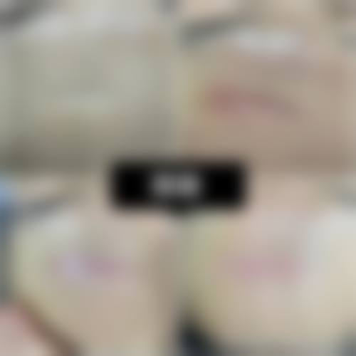 银川熙颜伊美医疗美容门诊部价格表