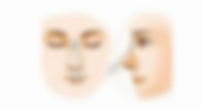 广州高尚医学美容中 心李春明技术特点——郑州中医药大学第一附属医院（对称美学）