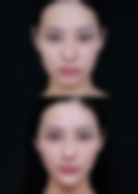 尹盛浩医生口碑如何