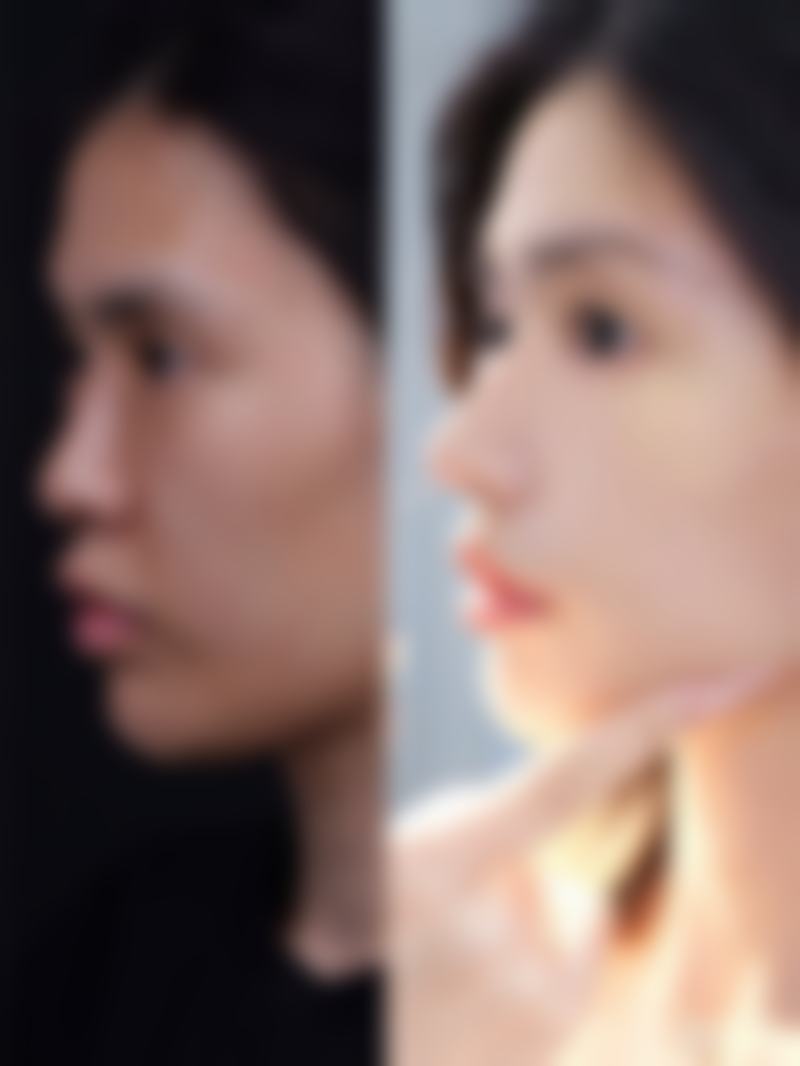 都匀黔南州中医院美容整形科价格表