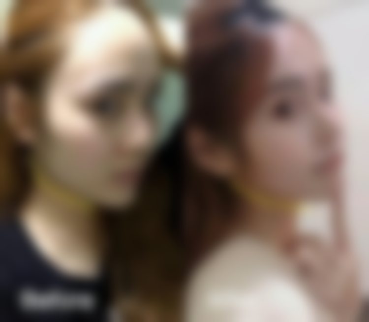 杭州连天美医疗美容医院李思彤真实评价——杭州连天美整形