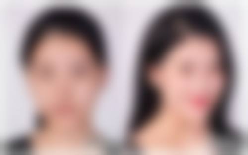 杨旭东医生简介口碑如何