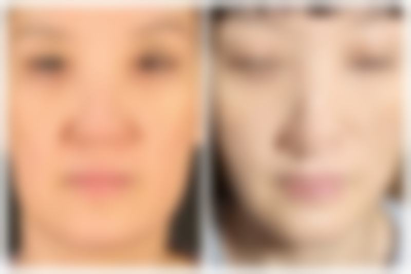 杨旭东医生简介怎么挂号