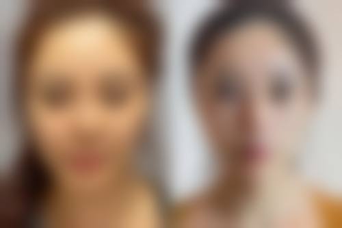 武汉斯启诺医疗美容门诊部怎么样——正规靠谱是关键
