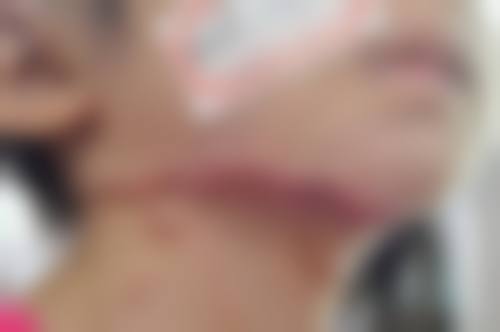 王在春医生怎么挂号