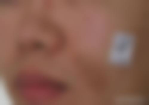 王在春医生顾客实例图片