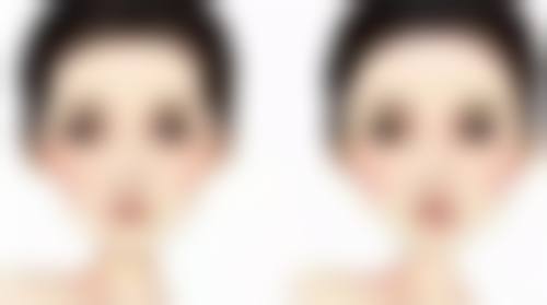 许更宇医生简介做手术价格