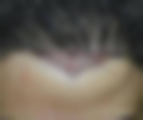陈黎明医生项目优势