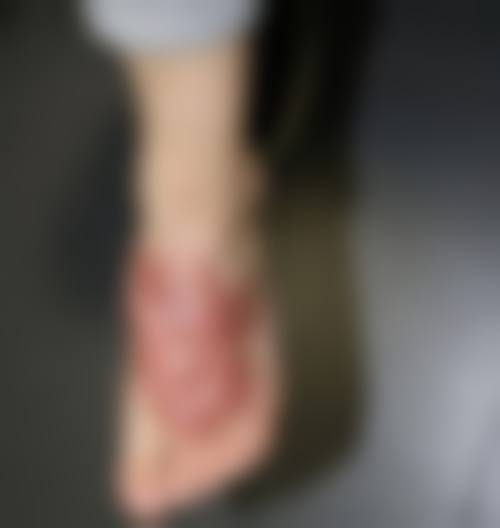 卢立春医生口碑如何