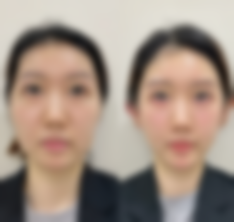 大庆东韩整形美容医院项目特色