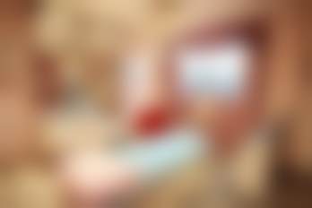 南昌佳美美容医院植发科价格表