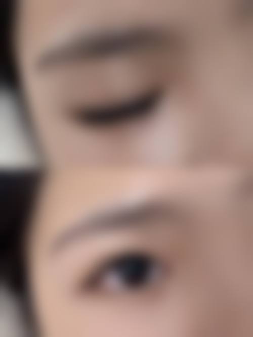 江南路美毛植发中 心口碑好不好，怎么样