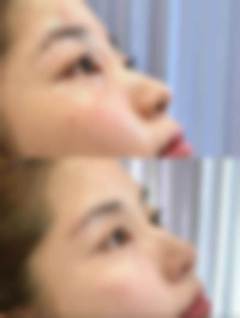莫梅医生项目优势