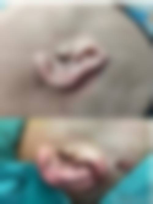 邯郸凯润婷整形美容医院品牌开业宣传活动