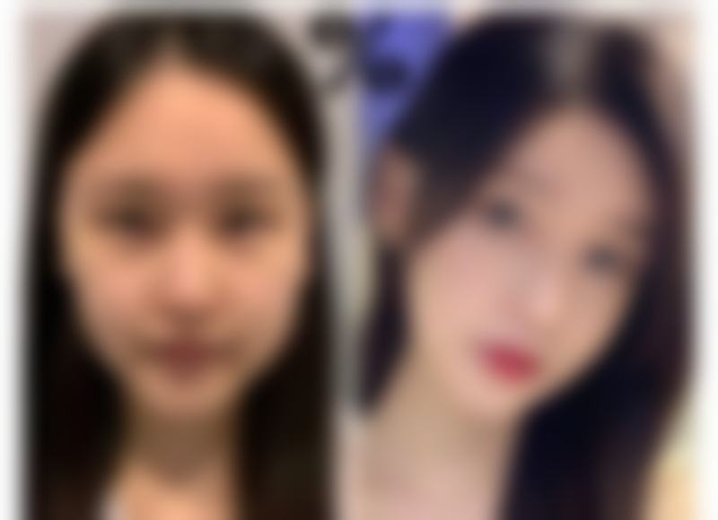 佛山禅城屋户整形医院地址及乘车路线