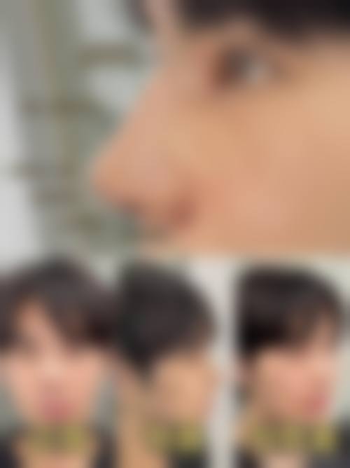 李晋福医生项目优势