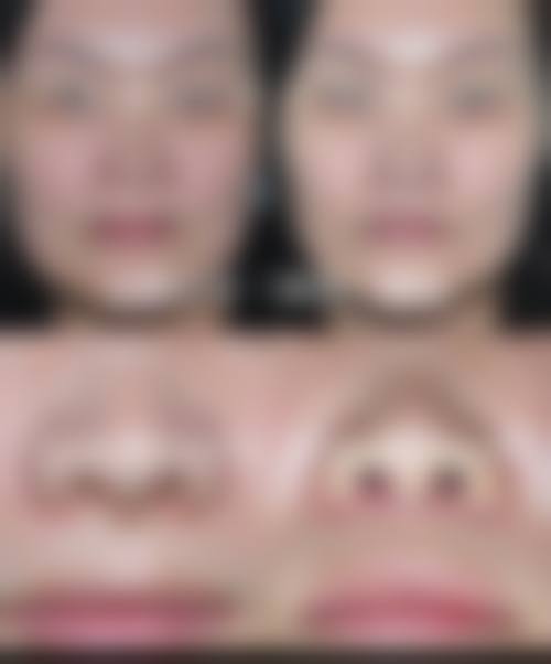 李晋福医生怎么挂号