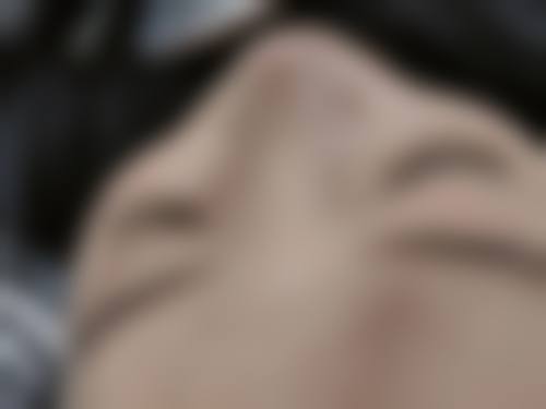 黄余芝医生简介项目优势