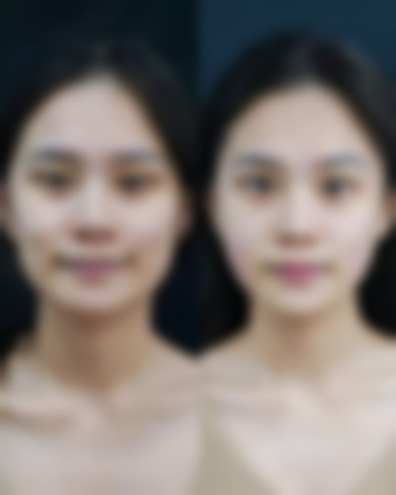 湖南黄兴医院整形美容中 心项目特色