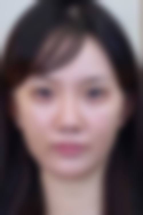 郭庆医生项目优势
