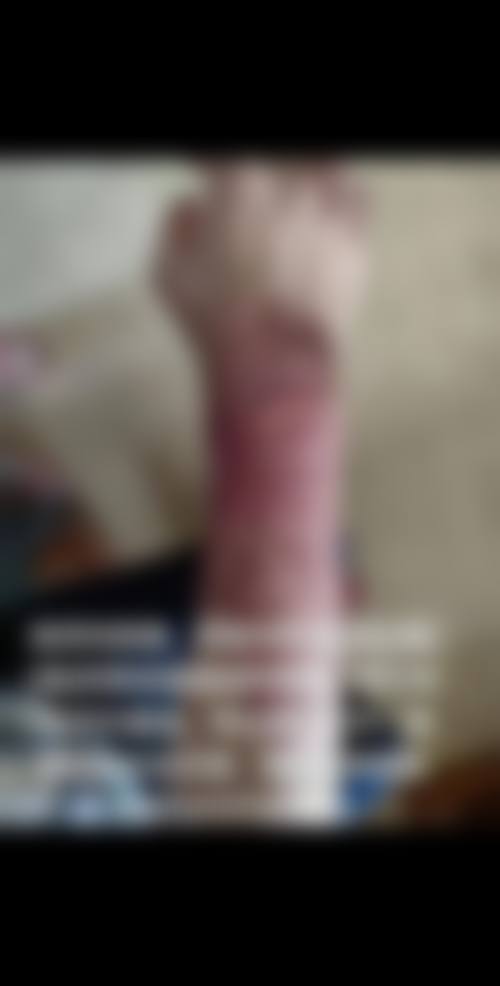 丽优美皮肤科怎么样，抖音团购活动和价格表