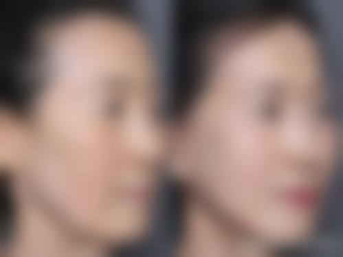 宋维芳医生顾客实例图片