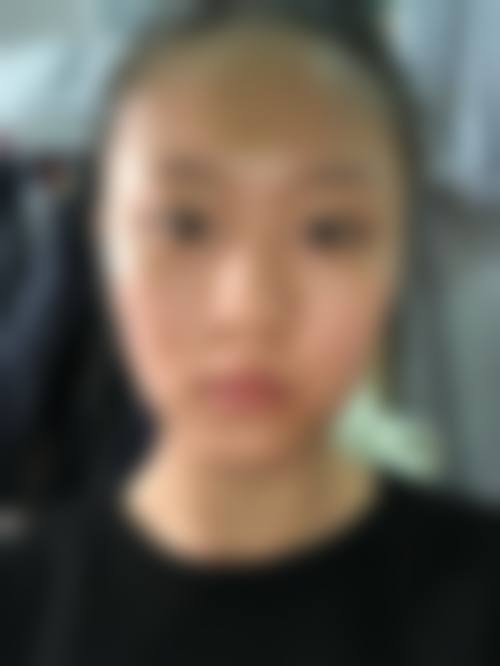 呼伦贝尔薇斯医疗美容门诊部怎么样,顾客实例展示