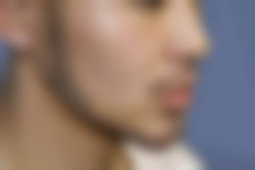 闫风芹医生口碑如何