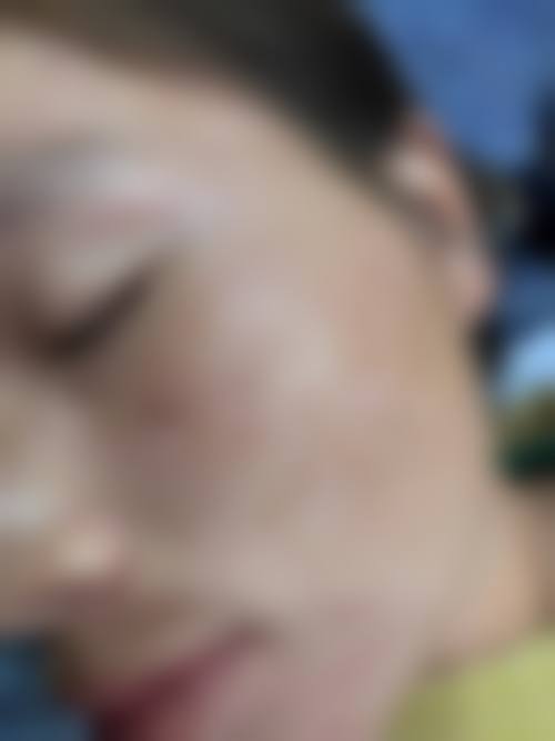 温树森医生项目优势