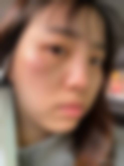 闫风芹医生项目优势