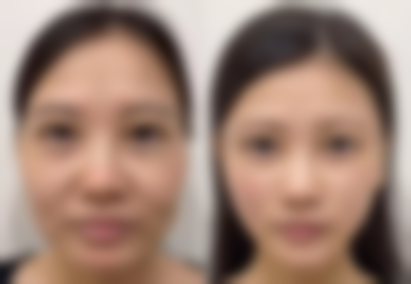 福州韩尔整形美容医院项目特色