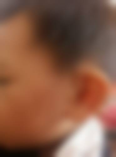 深圳阿克曼皮肤门诊部怎么样，地址在哪里