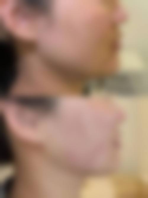 重庆杨洋整形医疗美容诊所更擅长什么手术