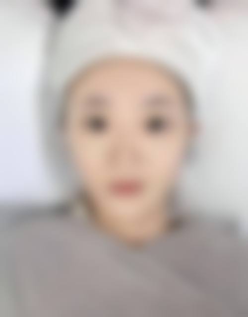 李瑶医生简介做手术价格