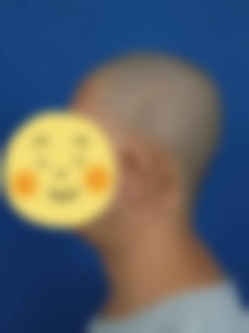 张素姣医生项目优势