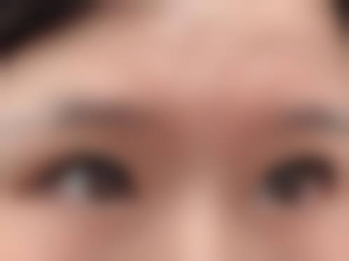 医美整形失败典型实例